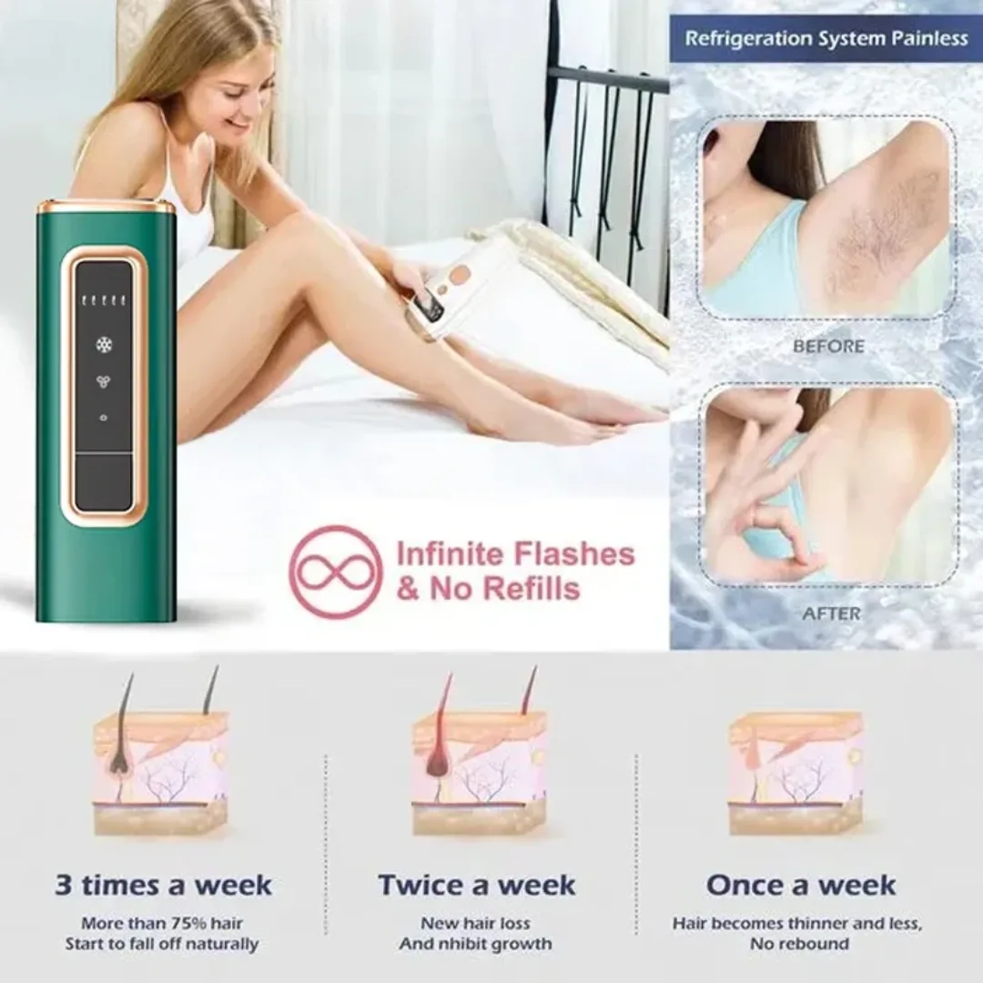 S7 IPL Hair Removal Machine - Professional for Women & Men - Image 5