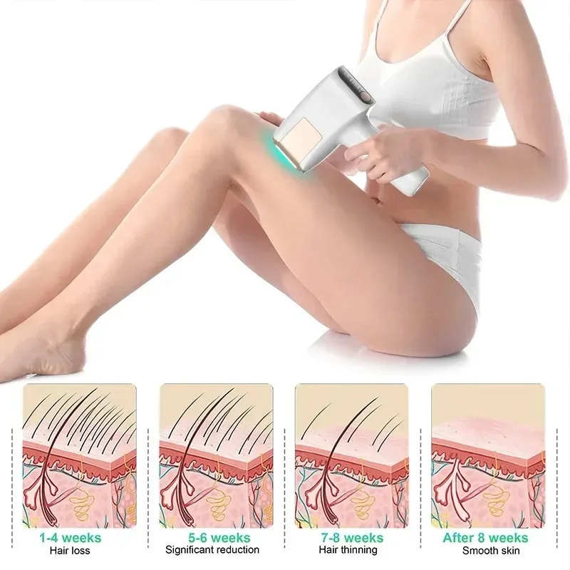 S2 IPL Hair Removal Machine - Professional for Women & Men - Image 4
