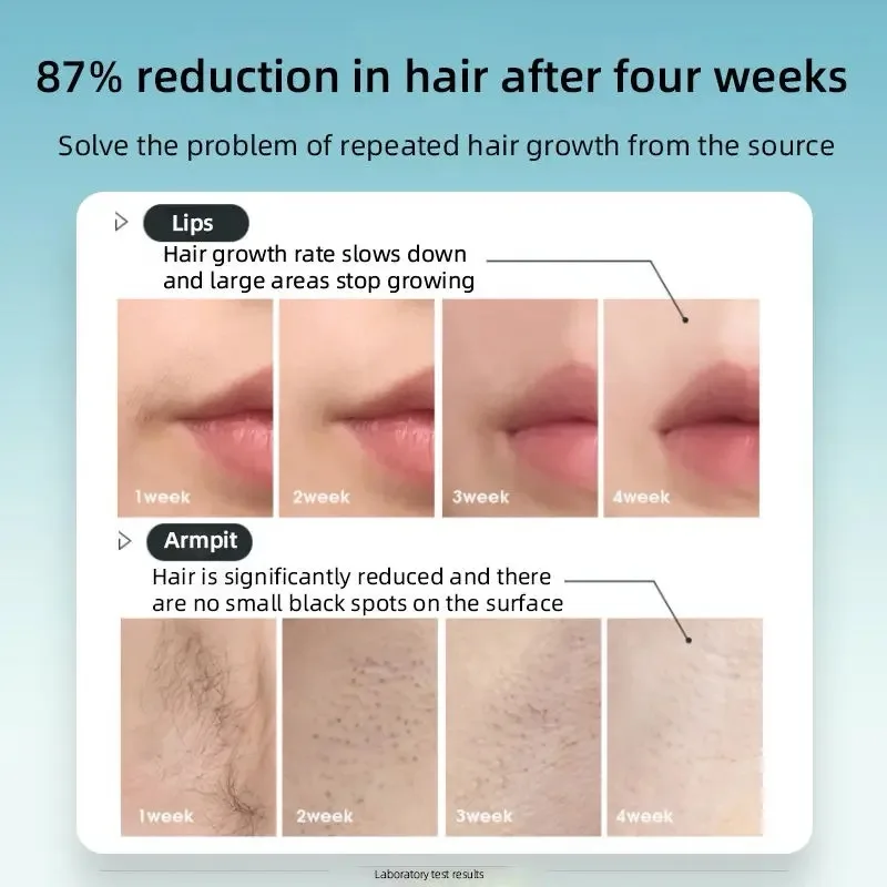 S4 IPL Hair Removal Machine - Professional for Women & Men - Image 7