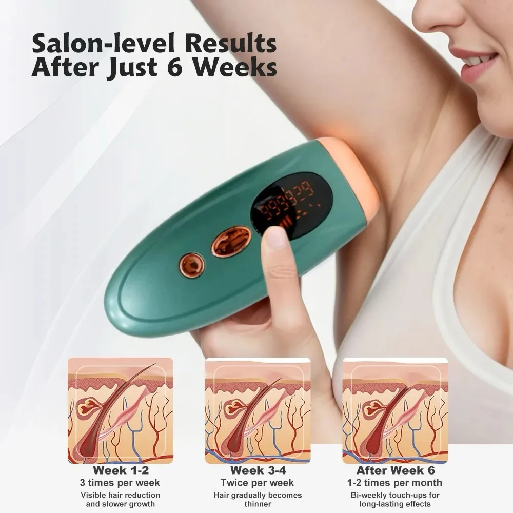 S6 IPL Hair Removal Machine - Professional for Women & Men - Image 4